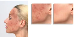 Discount BADER ELITE Cover Make-up HELL